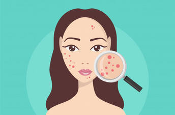acne-et-cure--ConvertImage-ConvertImage