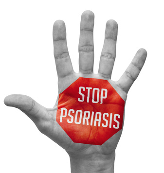 Cure thermale et Psoriasis